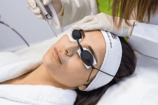 Fotona Laser Rejuvenation – Facial Tightening & Glow 1