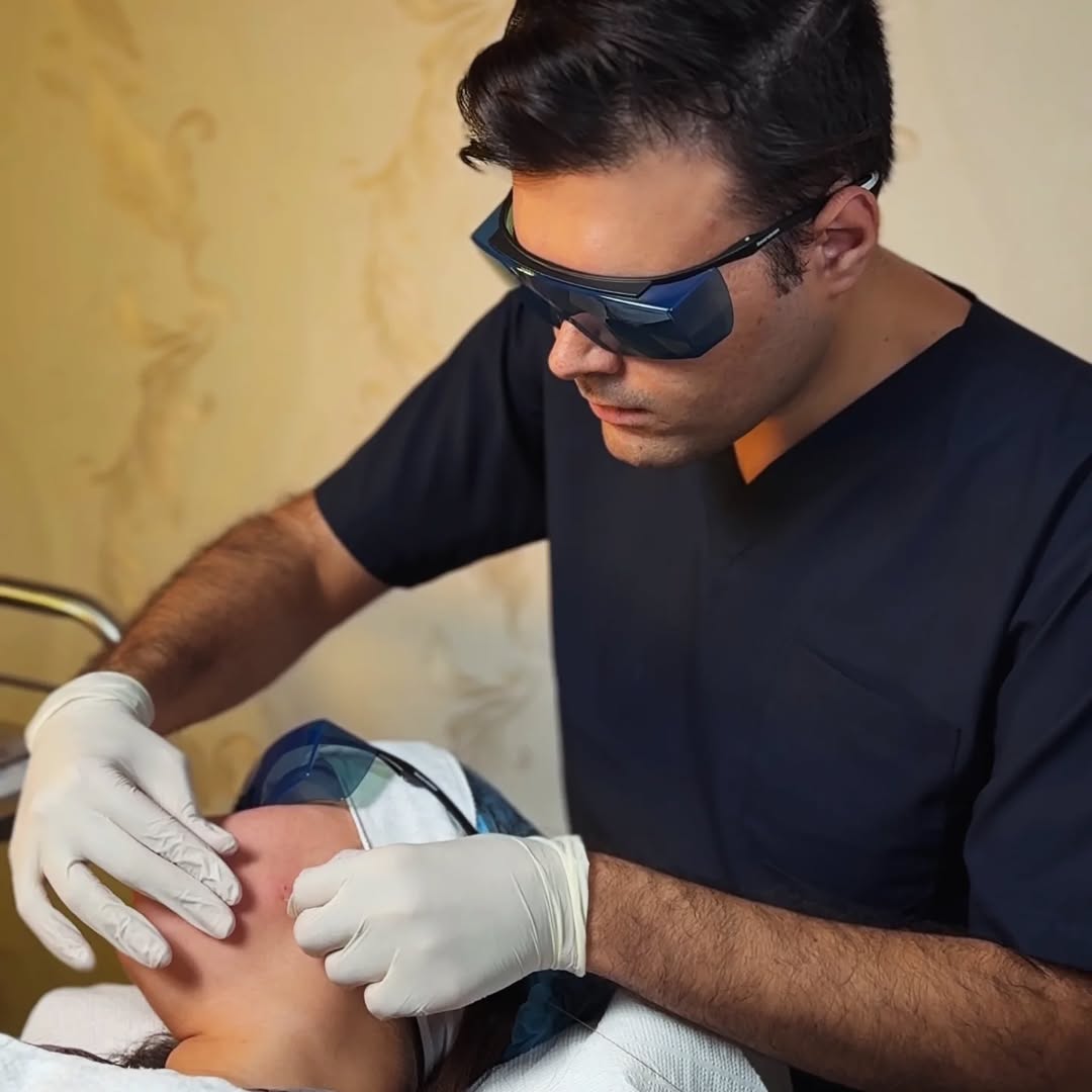 Endolift Laser – Precision Lifting & Skin Tightening 2